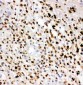 Anti-MPO Antibody